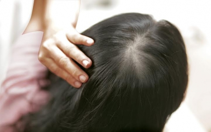 Bí kíp chăm sóc da đầu vào mùa hanh khô hiệu quả nhất